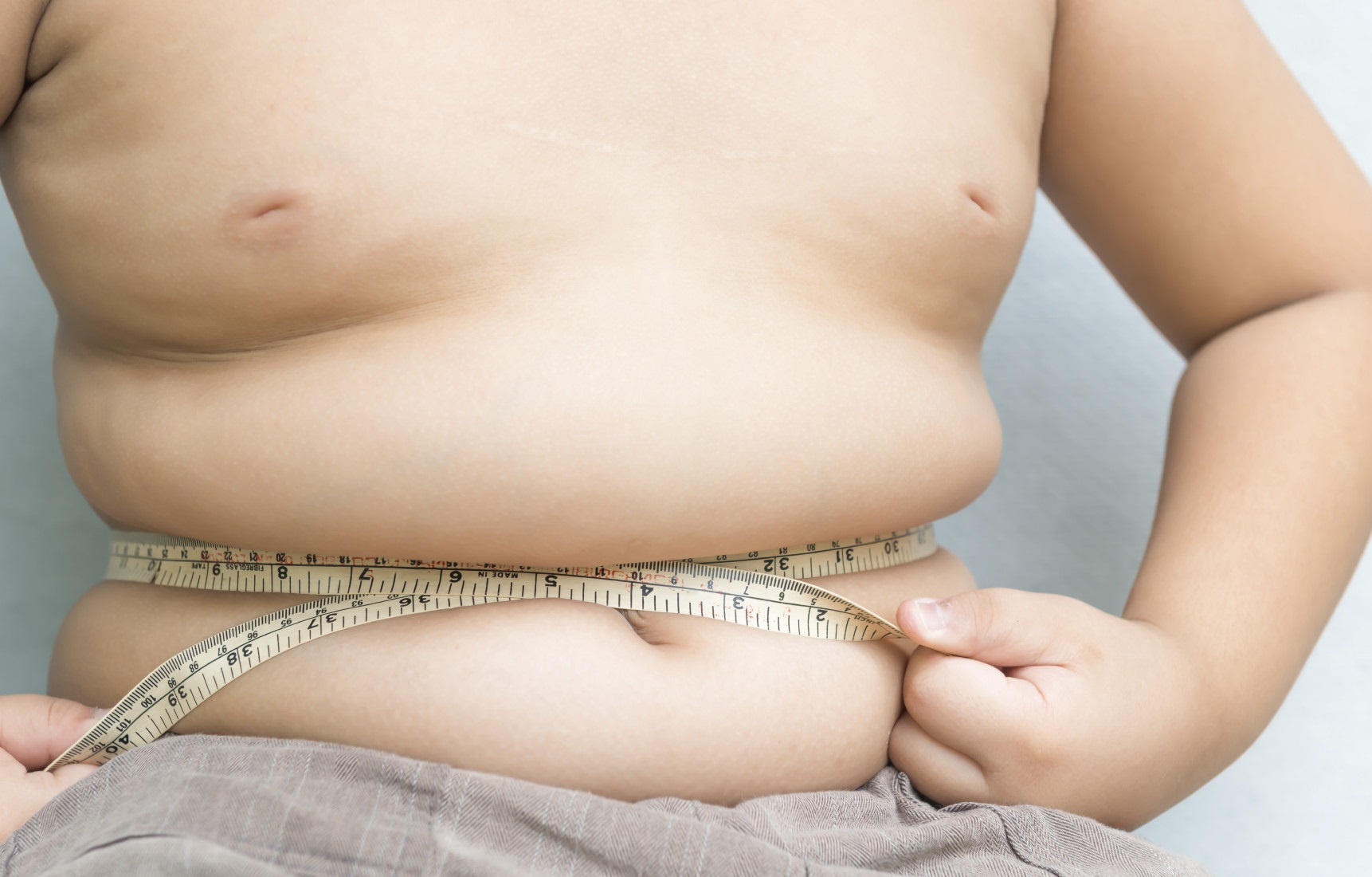 Trẻ bị béo phì sẽ hạn chế phát triển về chiều cao